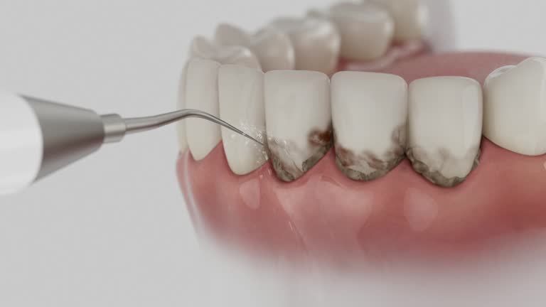 Reliable Dental Implants contractor in Steeleville, IL by Smile Center Dentistry